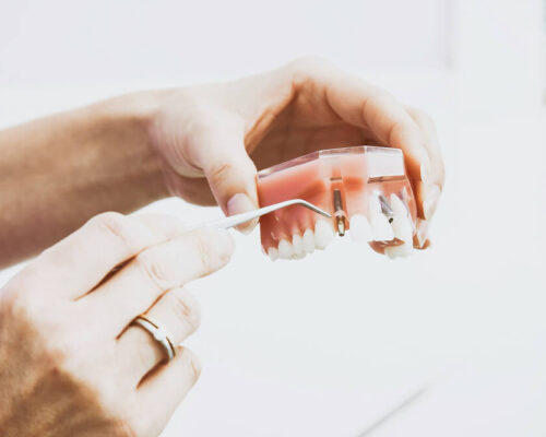 Dental implant procedure at accredited clinic in Istanbul Turkey