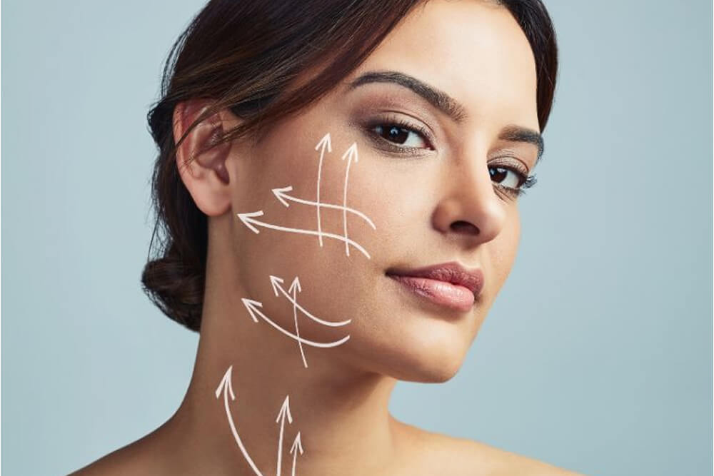 Endoscopic Face Lift