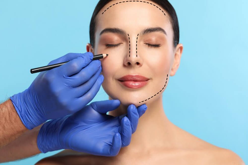 Facelift Surgery