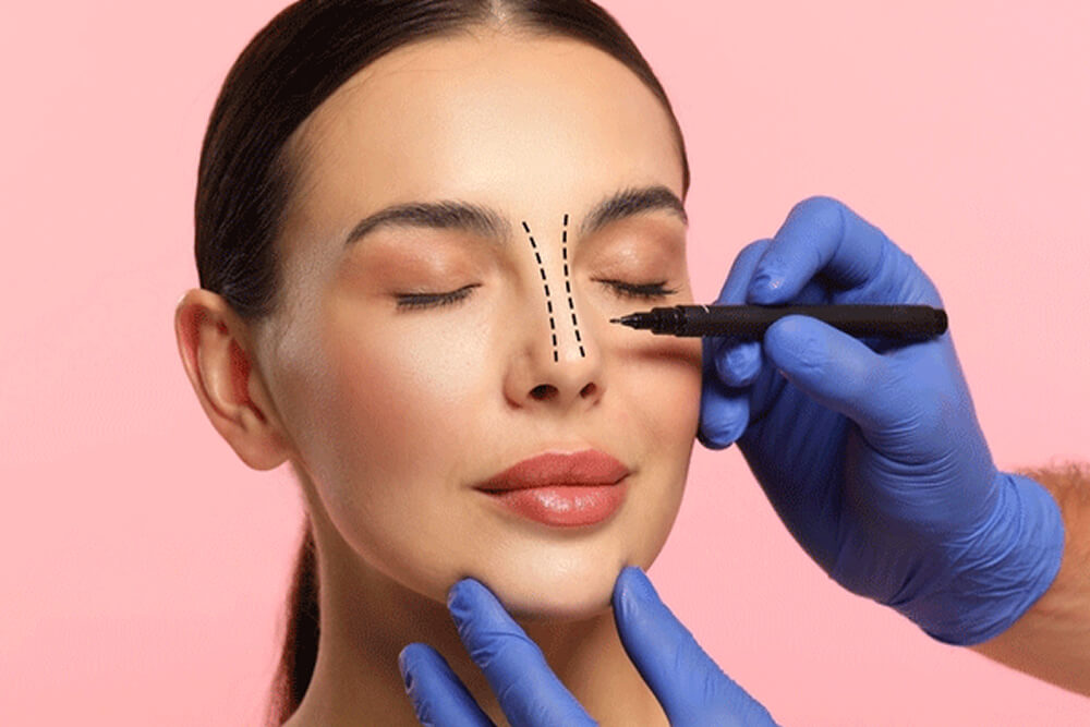 Rhinoplasty Santeclinicturkey